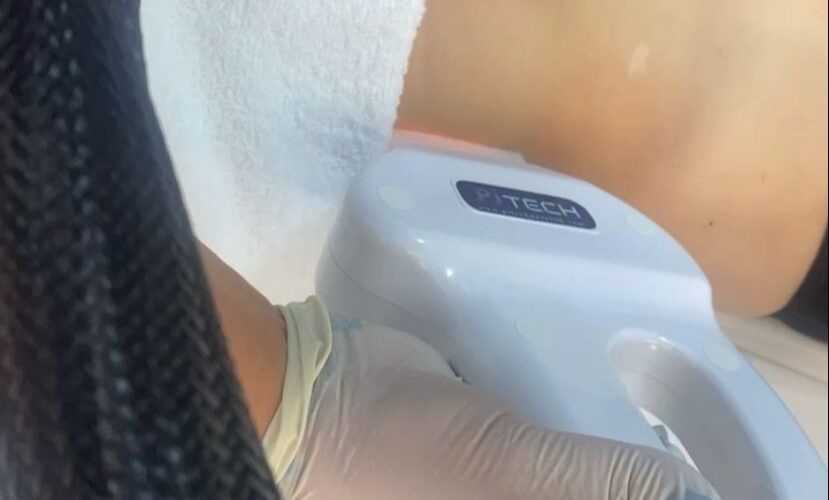 Helin aluz güzellik merkezi lazer epilasyon