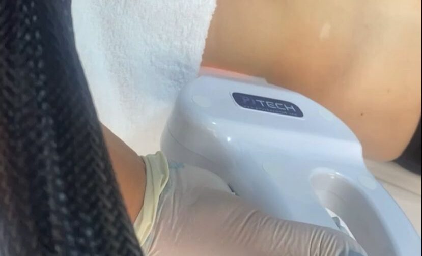 Helin aluz güzellik merkezi lazer epilasyon